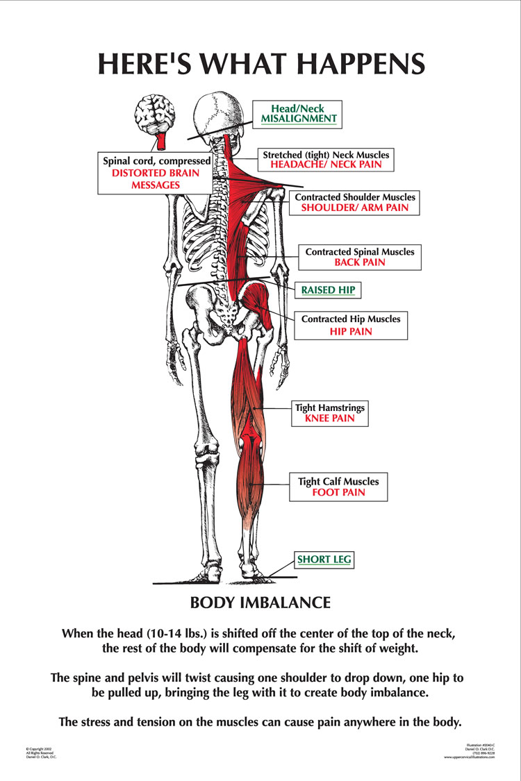 neck chiropractor illinois