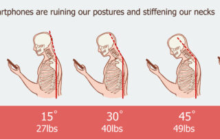 bad posture