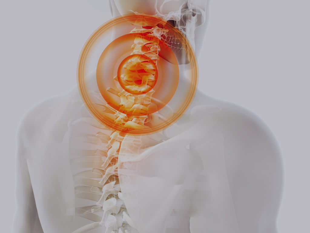 the-root-cause-of-complex-health-problems-atlas-subluxation