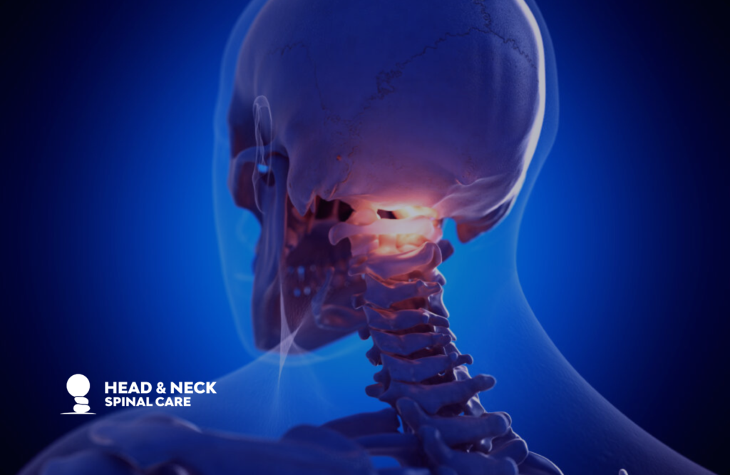 nucca chiropractic care focusing on the upper cervical spine atlas vertebrae