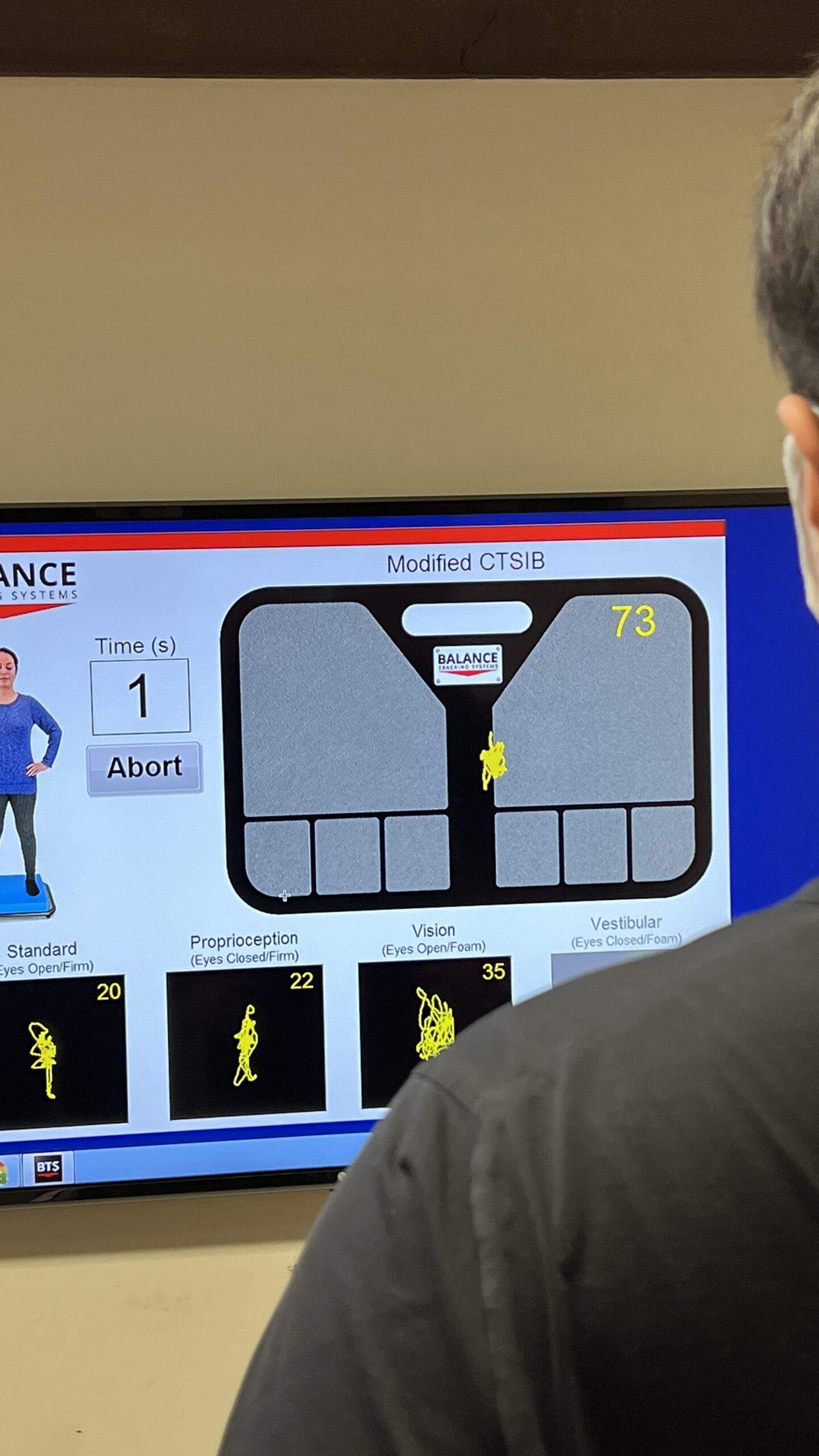 Balance training for concussion and brain injury patients in chiropractic office