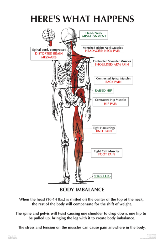 posture_nucca_care